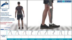Darstellung der Funktion einer Orthese KAFO mit gesperrtem Kniegelenk und deutlicher Oberkörperbewegung durch Hüfthebung Hip hiking und Zirkumduktion in der mittleren Schwungphase