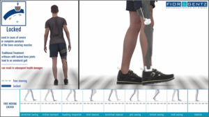 display of function of an orthosis KAFO with locked knee joint and significant upper body movement due to hip hiking and circumduction in mid swing phase