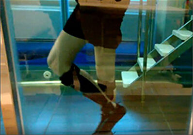 Patient video of a patient with paraplegia after a skiing accident. The patient is able to do walking exercises in a pool using custom-made lower leg orthoses AFOs with water-resistant ankle joints.