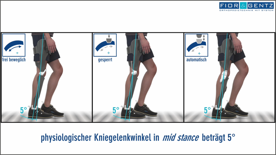 Vergleich der Funktion einer Orthese KAFO in der Seitenansicht jeweils mit frei beweglichem gesperrtem und automatischem Kniegelenk standphasen kontrolliert sco in der mittleren Standphase