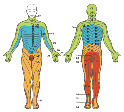 human map for showing the impairment scale ASIA classification using the pinprick test after paralysis after spinal cord injury paraplegia spinal cord lesion